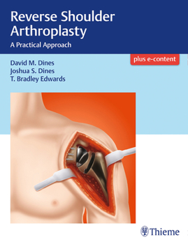 Hardcover Reverse Shoulder Arthroplasty: A Practical Approach Book