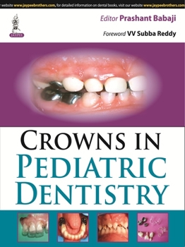 Paperback Crowns in Pediatric Dentistry Book