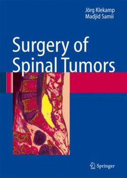 Paperback Surgery of Spinal Tumors Book