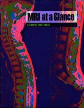 Paperback MRI at a Glance Book