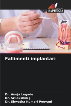 Paperback Fallimenti implantari [Italian] Book