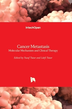 Hardcover Cancer Metastasis - Molecular Mechanism and Clinical Therapy Book
