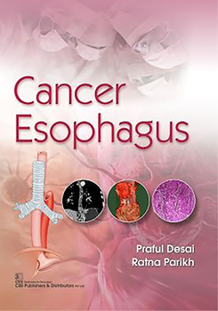 Paperback Cancer Esophagus Book