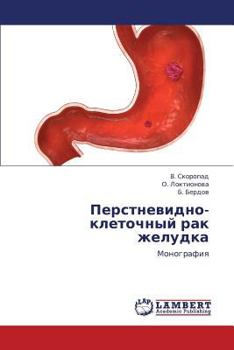 Paperback Perstnevidno-Kletochnyy Rak Zheludka [Russian] Book