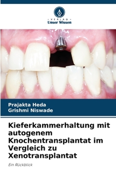 Paperback Kieferkammerhaltung mit autogenem Knochentransplantat im Vergleich zu Xenotransplantat [German] Book