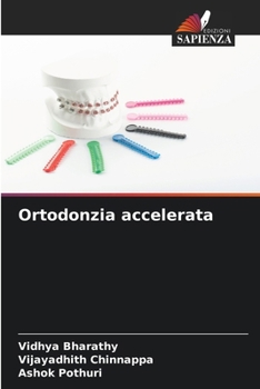 Paperback Ortodonzia accelerata [Italian] Book