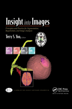 Hardcover Insight into Images: Principles and Practice for Segmentation, Registration, and Image Analysis Book