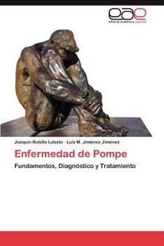 Paperback Enfermedad de Pompe [Spanish] Book