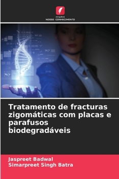 Tratamento de fracturas zigomáticas com placas e parafusos biodegradáveis (Portuguese Edition)