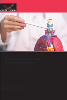 Paperback Mukowiscydoza - choroba pluc [Polish] Book