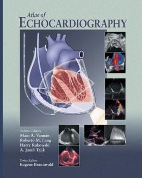 Hardcover Atlas of Echocardiography Book
