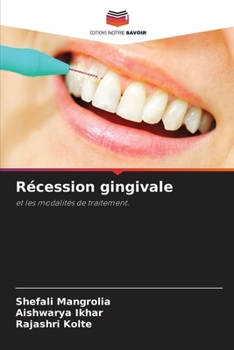 Paperback Récession gingivale [French] Book