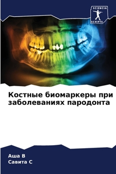 Paperback Костные биомаркеры при з [Russian] Book