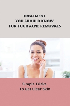 Paperback Treatment You Should Know For Your Acne Removals: Simple Tricks To Get Clear Skin Book