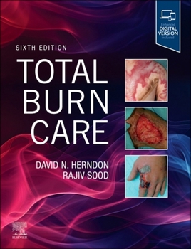 Hardcover Total Burn Care Book