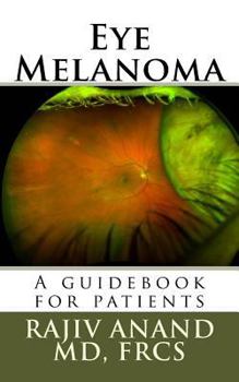 Paperback Eye Melanoma: A manual for patients Book