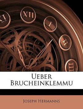 Paperback Ueber Brucheinklemmu [German] Book
