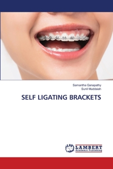 Self Ligating Brackets