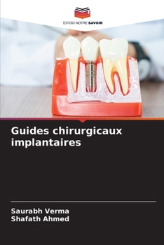 Paperback Guides chirurgicaux implantaires [French] Book