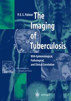 Paperback The Imaging of Tuberculosis: With Epidemiological, Pathological, and Clinical Correlation Book