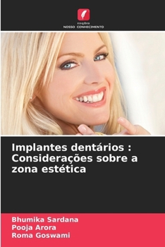 Paperback Implantes dentários: Considerações sobre a zona estética [Portuguese] Book