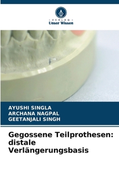 Gegossene Teilprothesen: distale Verlängerungsbasis (German Edition)