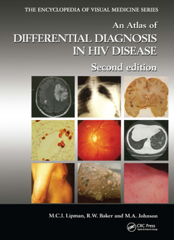 Hardcover An Atlas of Differential Diagnosis in HIV Disease Book