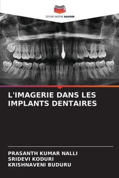 Paperback L'Imagerie Dans Les Implants Dentaires [French] Book