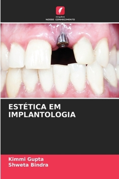 Estética Em Implantologia (Portuguese Edition)
