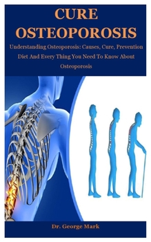 Paperback Cure Osteoporosis: Understanding Osteoporosis: Causes, Cure, Prevention Diet And Every Thing You Need To Know About Osteoporosis Book