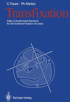 Paperback Transfixation: Atlas of Anatomical Sections for the External Fixation of Limbs Book