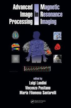 Hardcover Advanced Image Processing in Magnetic Resonance Imaging Book