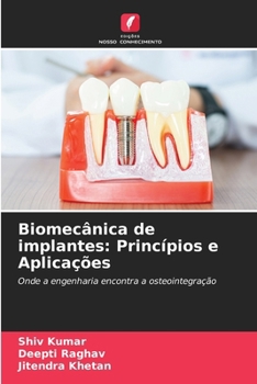 Biomecânica de implantes: Princípios e Aplicações (Portuguese Edition)