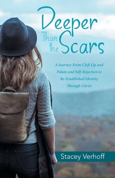 Paperback Deeper Than the Scars: A Journey from Cleft Lip and Palate and Self-Rejection to Re-Established Identity Through Christ Book