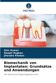 Biomechanik von Implantaten: Grundsätze und Anwendungen (German Edition)