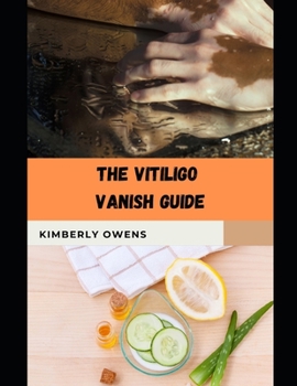 Paperback The Vitiligo Vanish Guide: Alternative and Homeopathic Paths to Treating Vitiligo Book