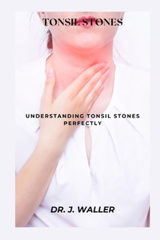 Paperback Tonsil Stones: Understanding Tonsil Stones Perfectly Book