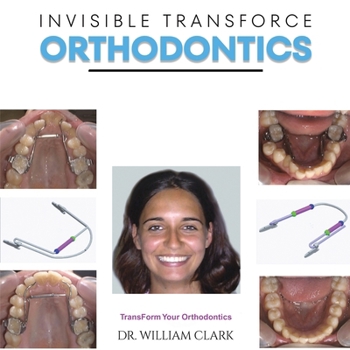 Paperback Invisible TransForce Orthodontics Book