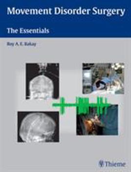 Hardcover Movement Disorder Surgery: The Essentials Book