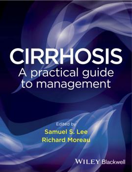 Hardcover Cirrhosis: A Practical Guide to Management Book