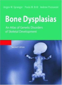 Hardcover Bone Dysplasias Book