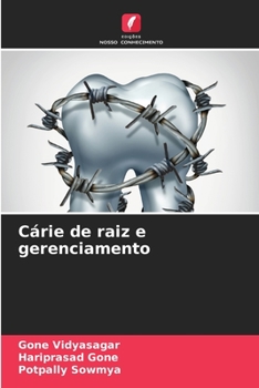 Paperback Cárie de raiz e gerenciamento [Portuguese] Book