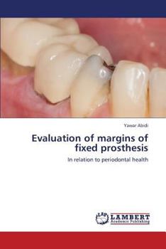 Evaluation of margins of fixed prosthesis: In relation to periodontal health