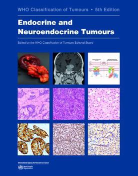 Endocrine and Neuroendocrine Tumours: WHO Classification of Tumours