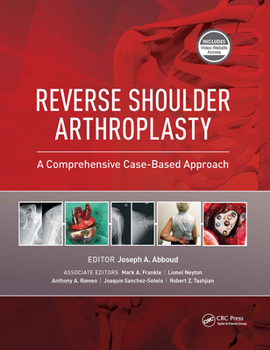 Hardcover Reverse Shoulder Arthroplasty: A Comprehensive Case-Based Approach Book