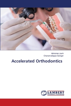Paperback Accelerated Orthodontics Book