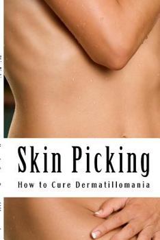 Paperback Skin Picking: How to Cure Dermatillomania Book