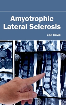 Hardcover Amyotrophic Lateral Sclerosis Book