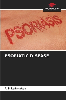 Paperback Psoriatic Disease Book