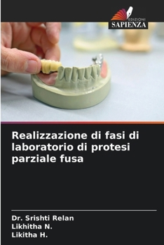Realizzazione di fasi di laboratorio di protesi parziale fusa (Italian Edition)